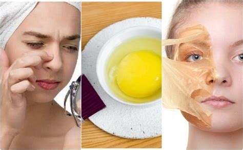 Las 5 mejores mascarillas de huevo para el cabello | Maske, Cilt bakımı ...