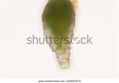 Difflugia Spprotozoa Under Microscope Stock Photo 636823072 | Shutterstock