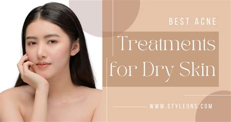 BEST ACNE TREATMENTS FOR DRY SKIN - Styleons - Medium