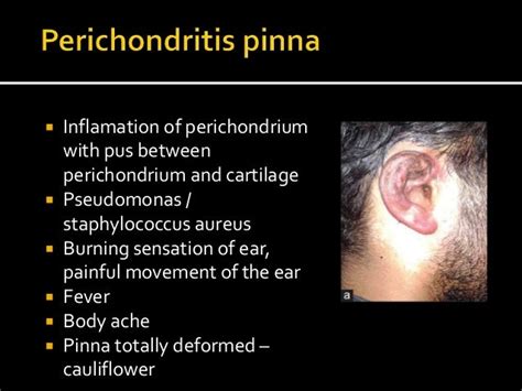 Diseases of the external ear