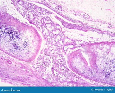 Histology of Epiglottis Human Tissue Stock Image - Image of study, view: 147728765