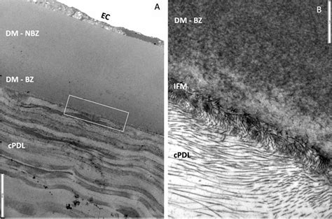 Histology of the interfacial matrix between the Descemet’s membrane ...