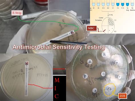 Antimicrobial Susceptibility Testing (AST): Introduction, Methods, Procedu