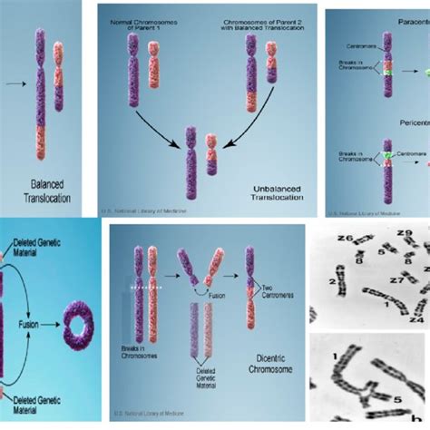 Structural chromosomal abnormalities. | Download Scientific Diagram