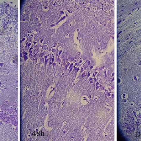 Normal cell population of pyramidal cells of hippocampus in DHA ? EPA ...