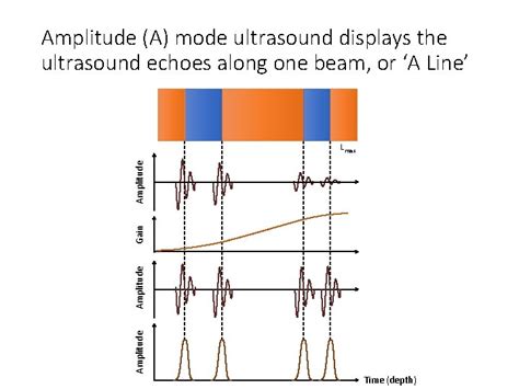 FRCR Ultrasound Lectures Dr Sarah Bohndiek seb 53cam