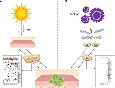 Frontiers | Merkel Cell Carcinoma: An Immunotherapy Fairy-Tale?