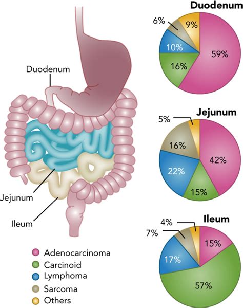 Small Bowel Adenocarcinoma: Etiology, Presentation, and Molecular Alterations in: Journal of the ...