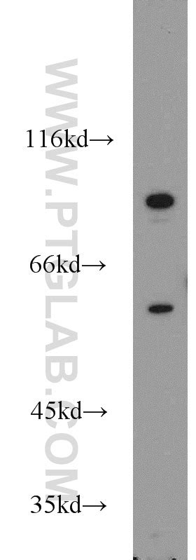 PCSK9 Antibody 55206-1-AP | Proteintech