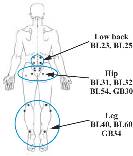 Lower Back Pain Acupuncture Points - Akupunktur Di Surabaya