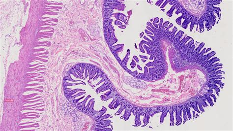 Human Duodenum Histology