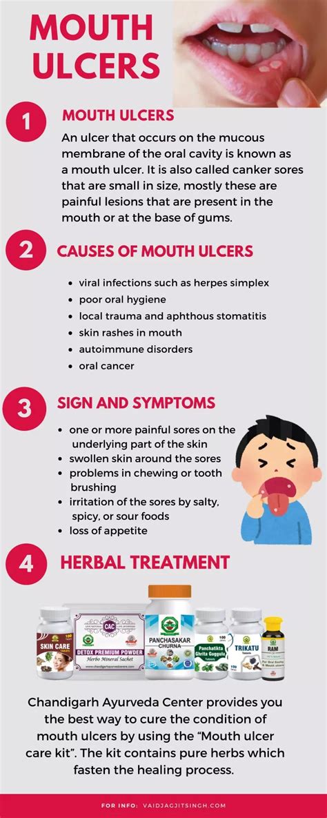 PPT - Mouth Ulcers - Causes, Symptoms and Herbal Treatment PowerPoint Presentation - ID:10121260