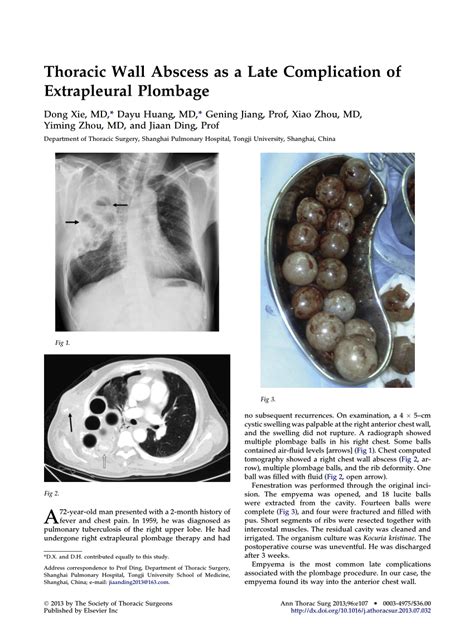 (PDF) Thoracic Wall Abscess as a Late Complication of Extrapleural Plombage