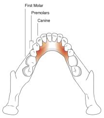 Three-Dimensional Model of Undocumented Lingual Nerve Branches for the ...