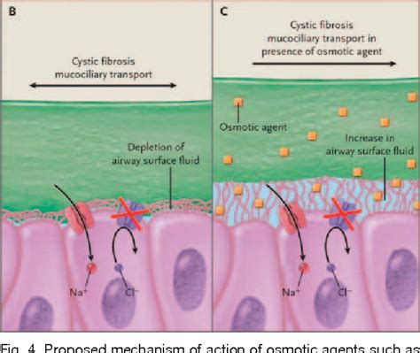 Figure 4 from Cystic fibrosis: pathogenesis and future treatment ...