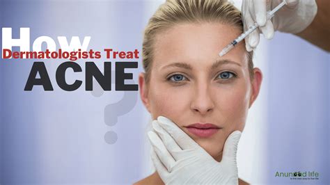 How Dermatologists Treat Acne?