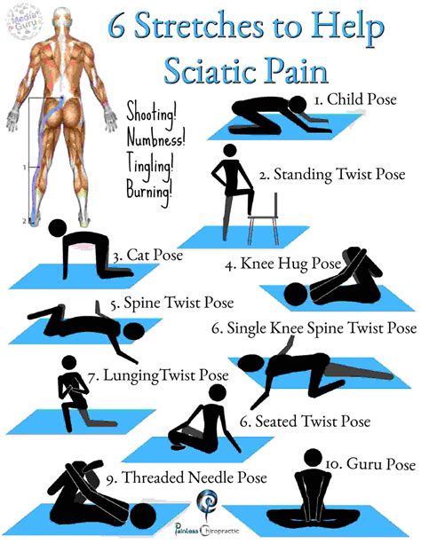 Sciatic Nerve Pain Relief -Safe and Effective Non-Surgical X-Ray Based ...