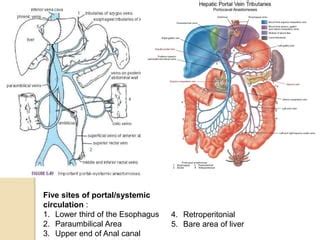 portacaval anastomosis | PPT