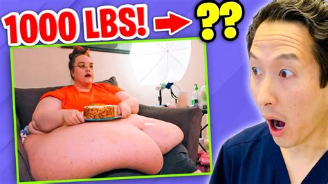 Plastic Surgeon Reacts to MY 600 LB LIFE! She went from 1000 lbs to ??? - YouTube