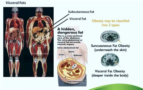 Types of Body Fat and the Dangers of Visceral Fat | DexaFit