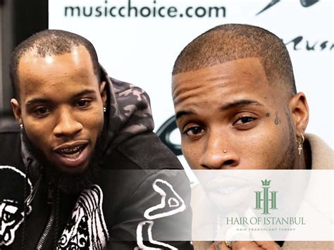 Tory Lanez Hair Transplant: A Closer Look at the Change