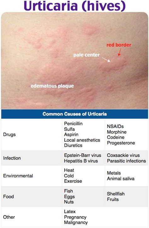 Rosh Review | Dermatology nurse, Nursing school tips, Nursing notes