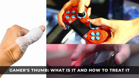 Gamer's Thumb: What Is It and How to Treat It - KeenGamer