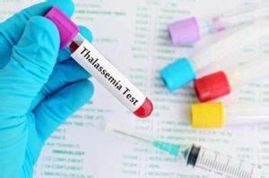 Thalassemia Major: Available Treatment Options