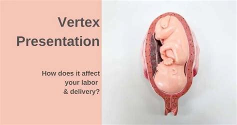 Vertex Presentation: How does it affect your labor & delivery? - ParentingNMore