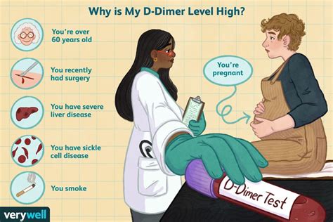 The D-Dimer Test: What You Should Know