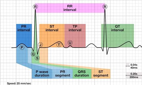 QT Interval • LITFL • ECG Library Basics