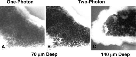 One vs two-photon microscopy