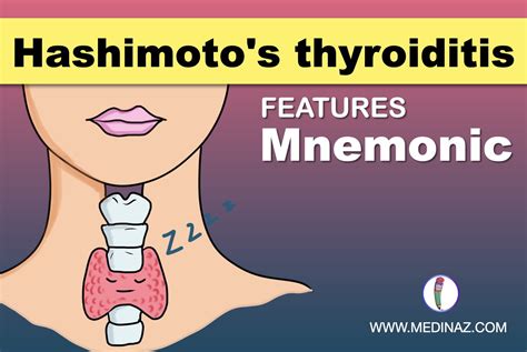 Hashimoto's thyroiditis Mnemonic