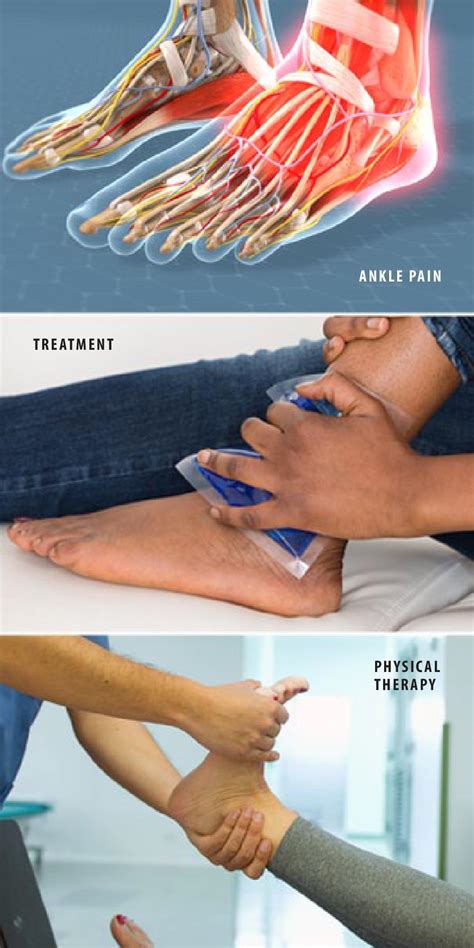 Causes Of Ankle Pain Painscale - vrogue.co