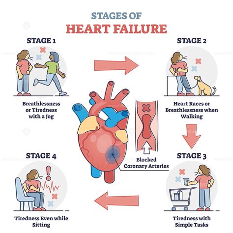 Pathophysiology Of Heart Failure Diagram Robhosking Diagram | The Best Porn Website