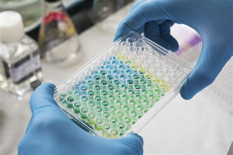 SOS Genotoxicity Tests