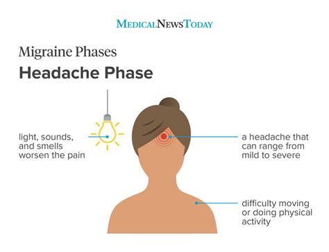 Severe Migraine Headaches