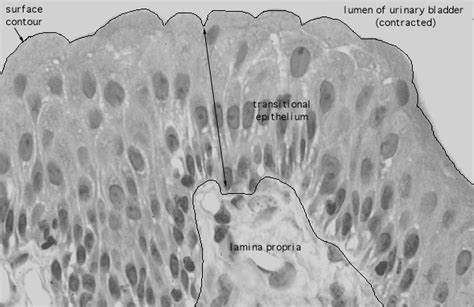 HLS [ Urinary System, urinary bladder, transitional epithelium] HIGH MAG labeled