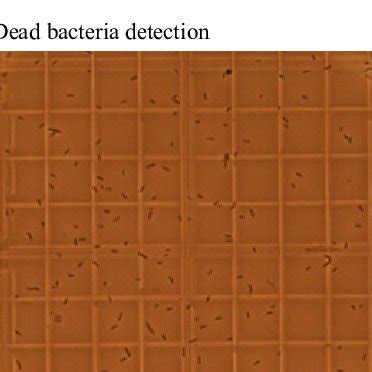 d: Live Bacillus thuringiensis as seen under the microscope, using a ...