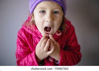 Adult Permanent Teeth Coming Behind Baby Foto de stock 770306233 | Shutterstock