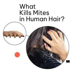 Hair Dandruff, Hair Scalp, Hair Hair, Mites On Humans, Demodex Mites, Skin Parasites, Itching ...