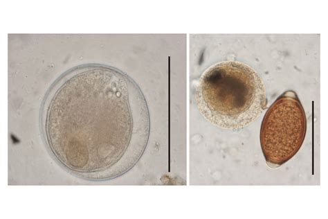 Balantidium coli cysts from a pig sample. Scale bar: 50 μm. Left ...