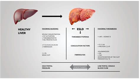 Individualized Management of Coagulopathy in Patients with End-Stage ...