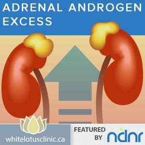 PCOS -Treating Adrenal Androgen Excess - Toronto Naturopath | Women's ...