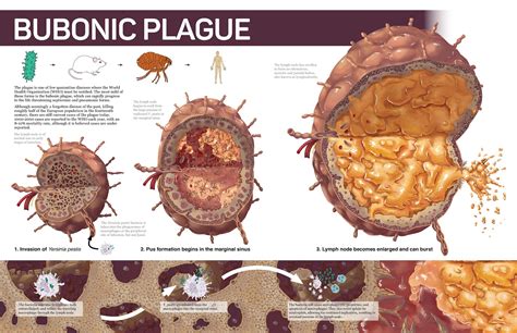 The Big Wobble : The World Health Organisation has warned this year's ...