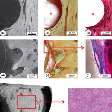 Micro-CT analysis showing implant (*) and bone. (a) single 2D X-ray... | Download Scientific Diagram