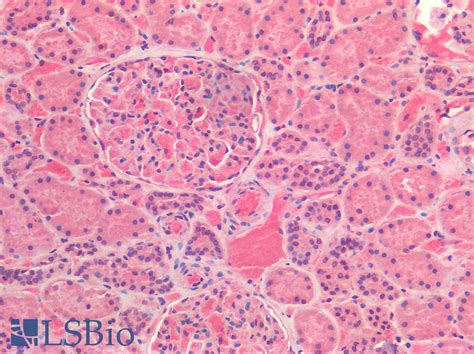 IHC-plus™ IL6 / Interleukin 6 Polyclonal Antibody Rabbit IHC | LSBio