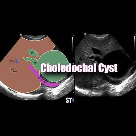 Ultrasound – Sonographic Tendencies