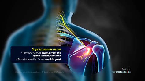 Suprascapular Nerve Block Video | Medical Video Library