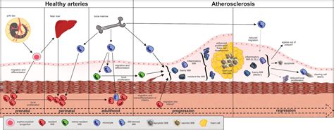 Atherosclerosis Plaque Specimen